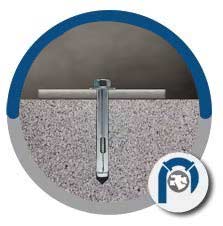 Stainless Steel Masonry Anchors